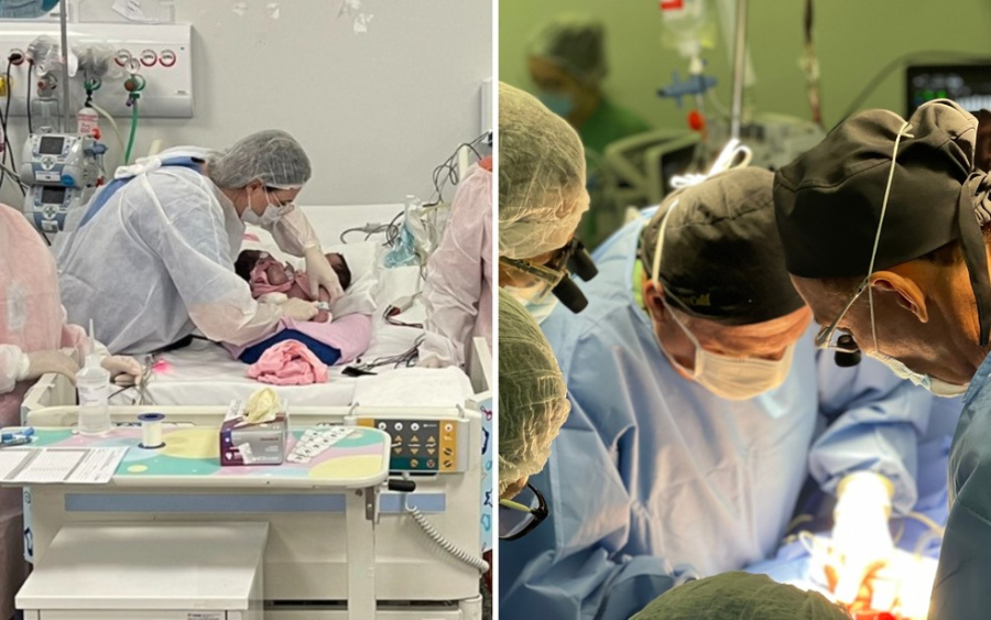 Gêmeas siamesas passam por cirurgia de urgência 